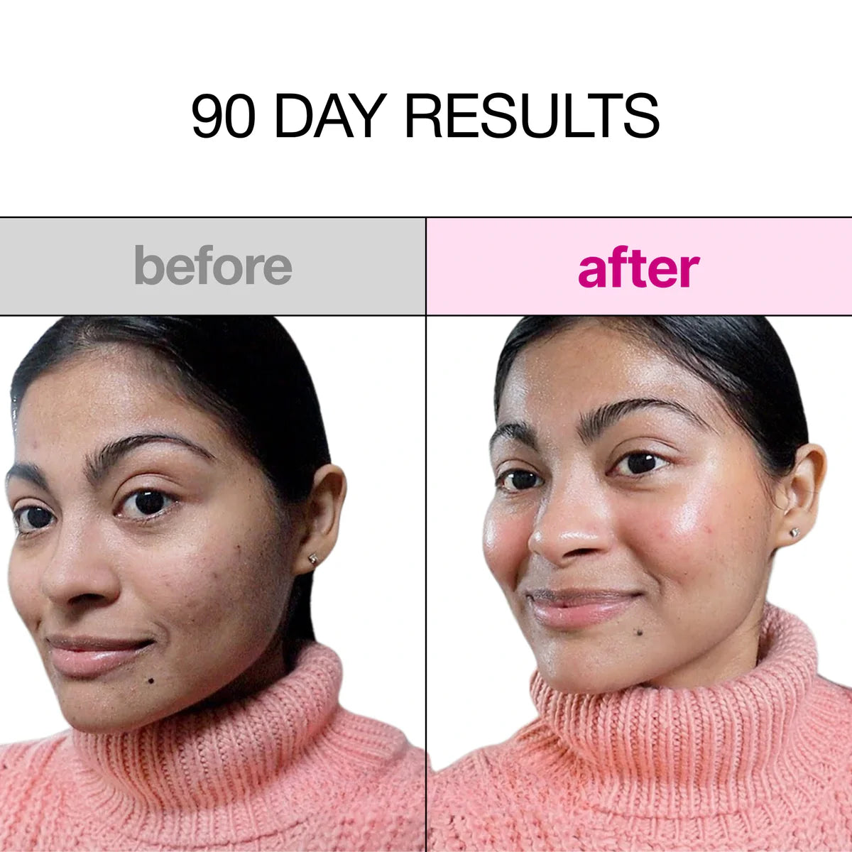 Bio-Collagen™ Deep Hydration & Repair Face Mask – Overnight Skin Rejuvenation